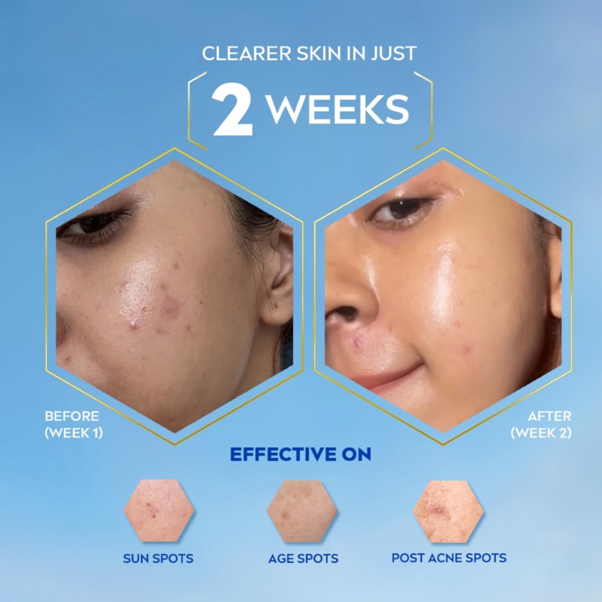NIVEA Luminous Even Glow Oil Control Day Cream & Moisturizer SPF 50 | Patented Thiamidol (60X More Effective Than Vitamin C) | Dark Spots & Pigmentation | Oil Control, Brightening & Even Tone with Hyaluronic Acid | 40ml - Image 5